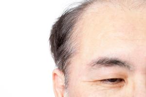 2026年最新｜船橋の医療脱毛で失敗しないための完全ガイド